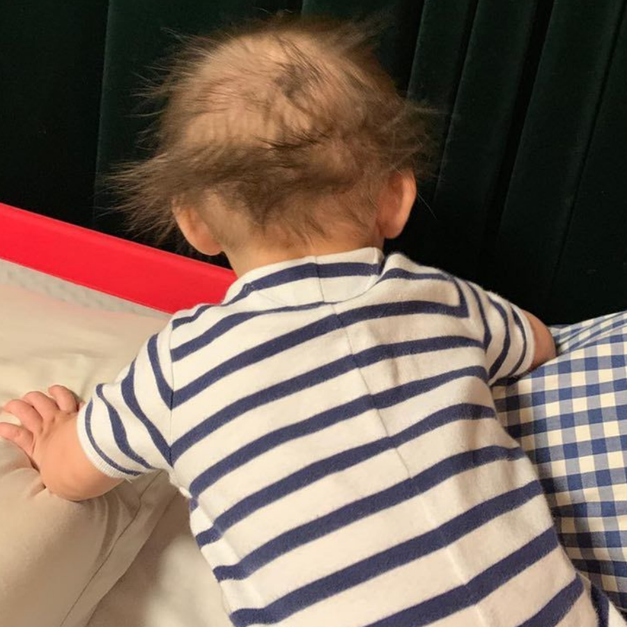 今天秃头了吗？