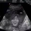 会喊666的皮皮虾