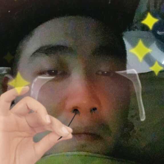 X强