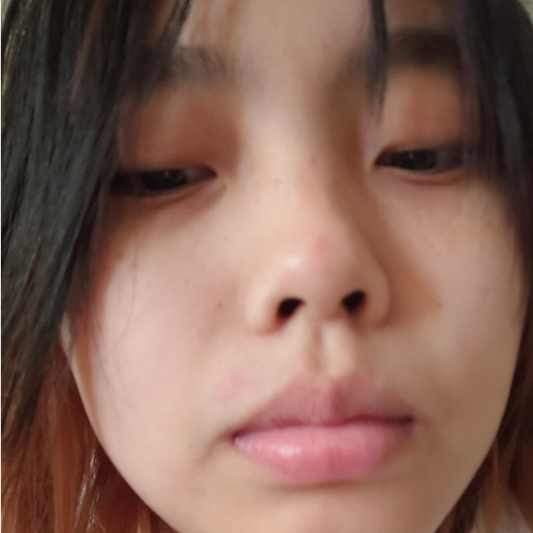 小土豆的皮