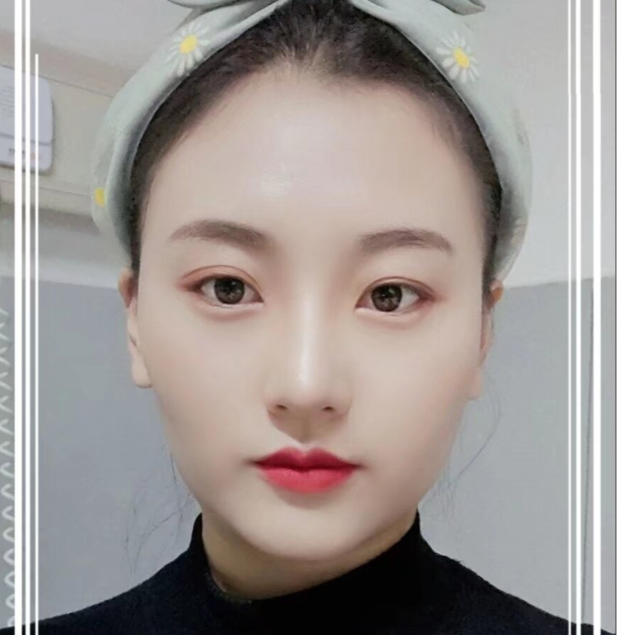 玫果