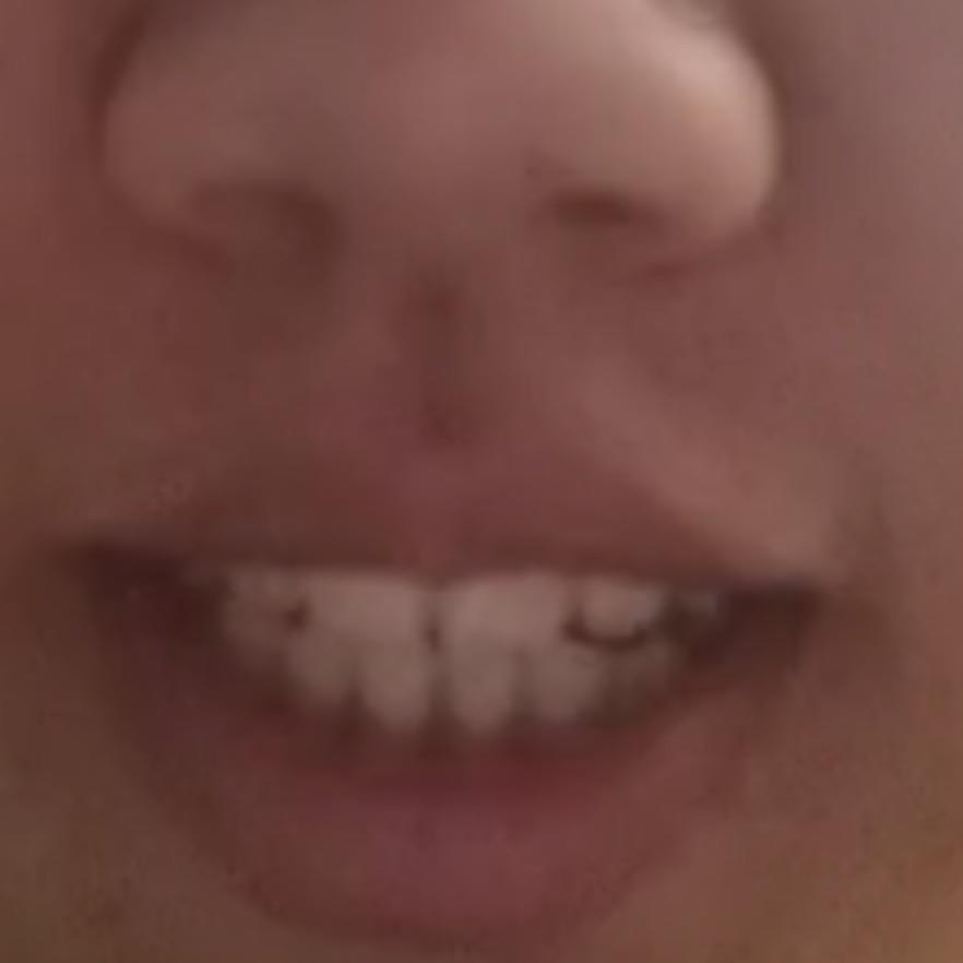 .......