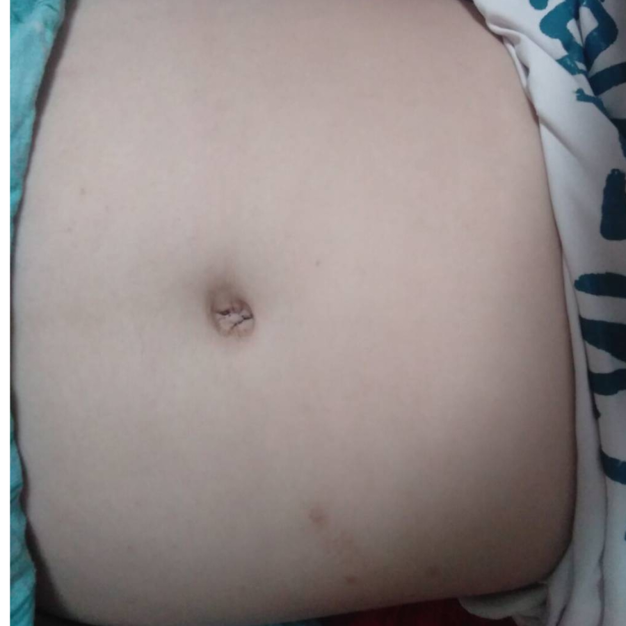 。