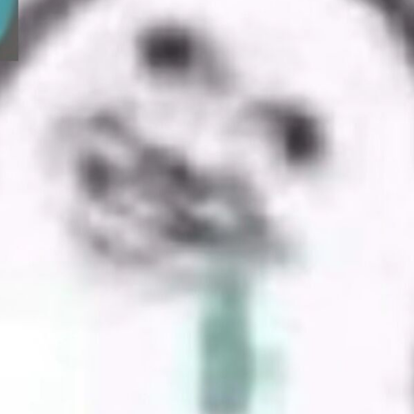 hmx