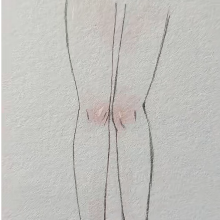 发飙的鱼