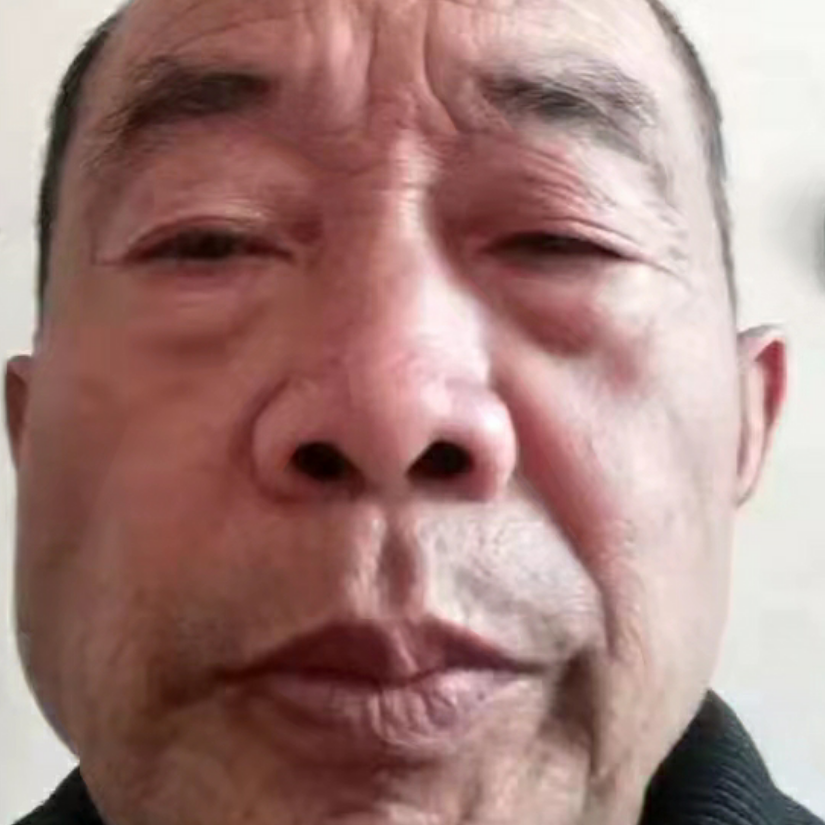 只因