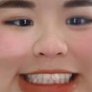 何皮皮